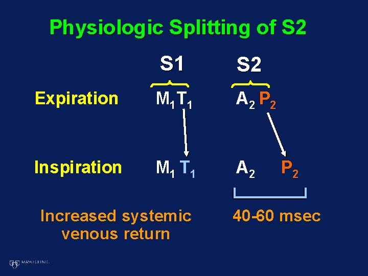 Physiologic Splitting of S 2 S 1 S 2 Expiration M 1 T 1