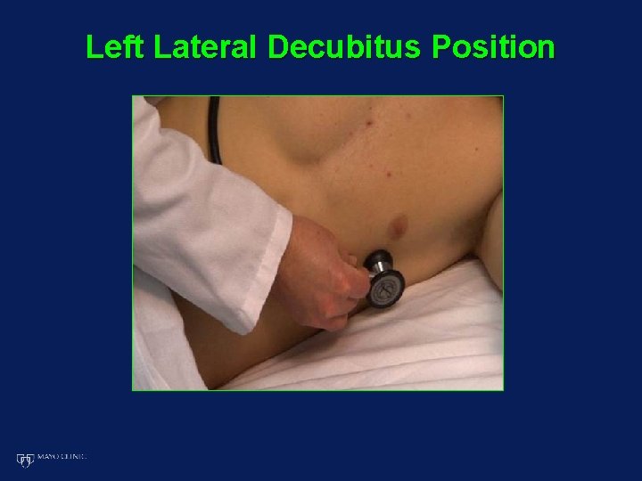 Left Lateral Decubitus Position 