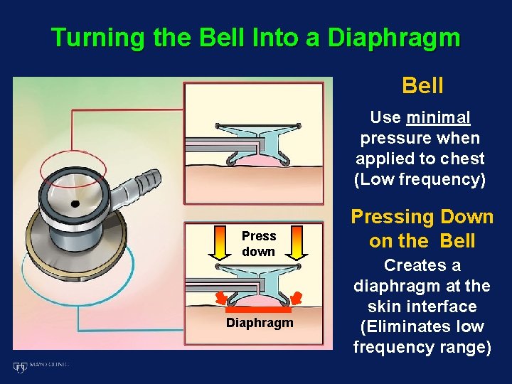 Turning the Bell Into a Diaphragm Bell Use minimal pressure when applied to chest