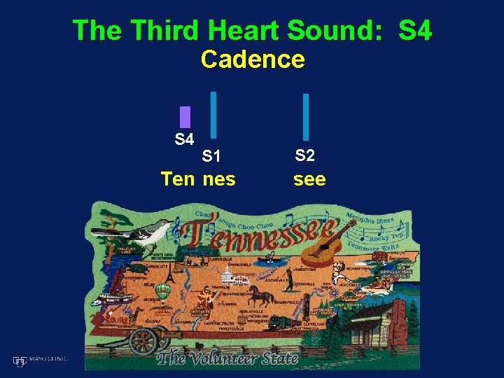 The Third Heart Sound: S 4 Cadence S 4 S 1 Ten nes S