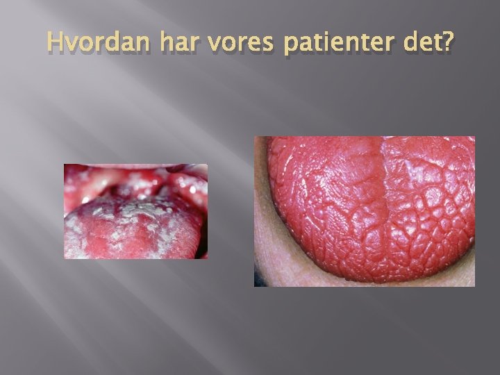 Hvordan har vores patienter det? Hvordan har vores patienter det?