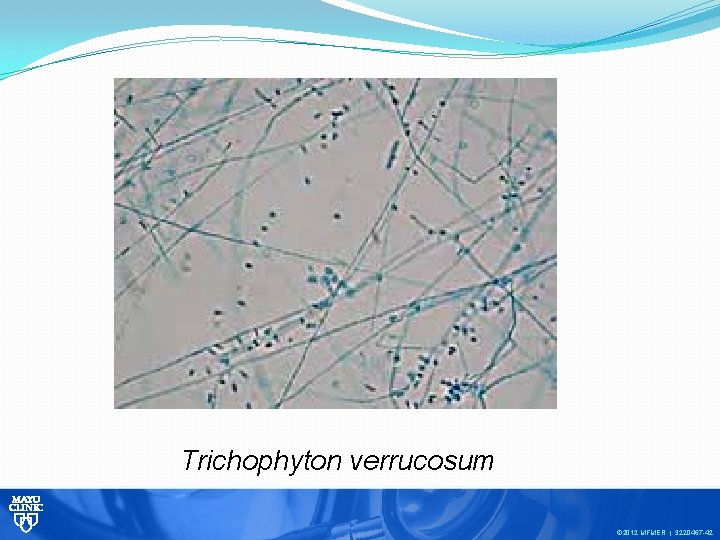 Trichophyton verrucosum © 2012 MFMER | 3220467 -42 