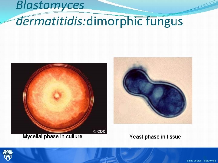 Blastomyces dermatitidis: dimorphic fungus Mycelial phase in culture Yeast phase in tissue 52 ©