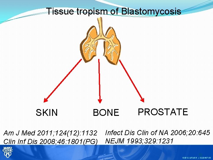 Tissue tropism of Blastomycosis SKIN BONE Am J Med 2011; 124(12): 1132 Clin Inf