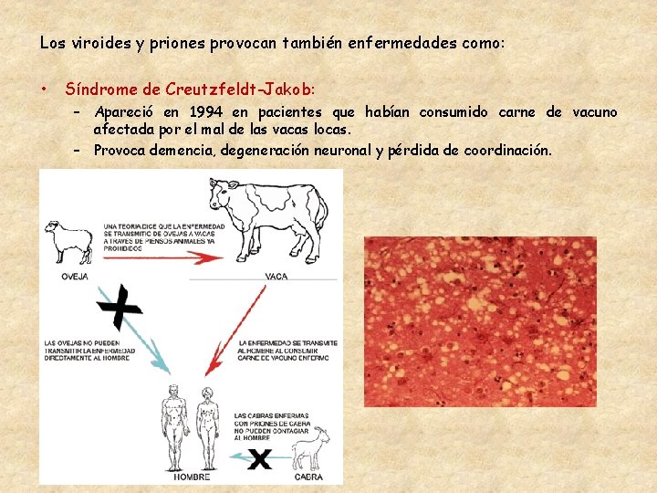 Los viroides y priones provocan también enfermedades como: • Síndrome de Creutzfeldt-Jakob: – Apareció