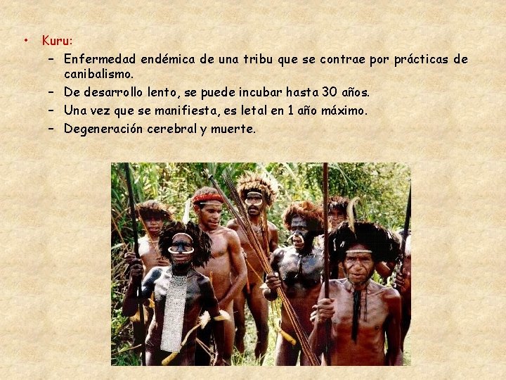  • Kuru: – Enfermedad endémica de una tribu que se contrae por prácticas