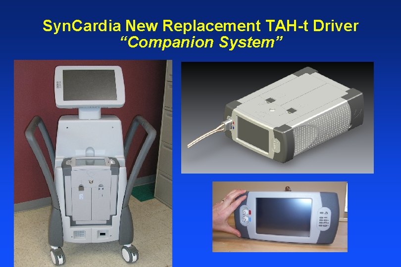 Syn. Cardia New Replacement TAH-t Driver “Companion System” 