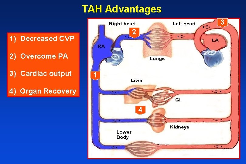 TAH Advantages 3 2 1) Decreased CVP 2) Overcome PA 3) Cardiac output 1