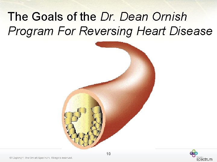 The Goals of the Dr. Dean Ornish Program For Reversing Heart Disease 10 