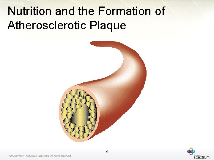 Nutrition and the Formation of Atherosclerotic Plaque 9 