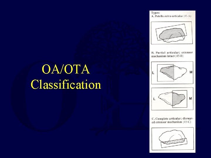 OA/OTA Classification 