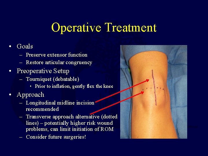 Operative Treatment • Goals – Preserve extensor function – Restore articular congruency • Preoperative