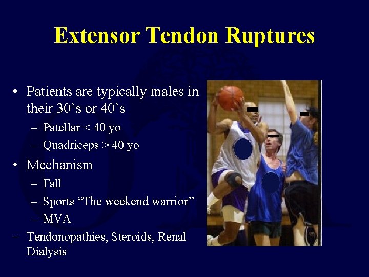 Extensor Tendon Ruptures • Patients are typically males in their 30’s or 40’s –