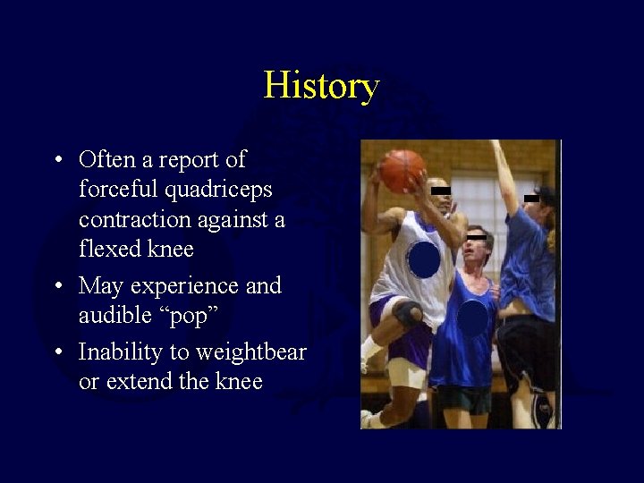 History • Often a report of forceful quadriceps contraction against a flexed knee •