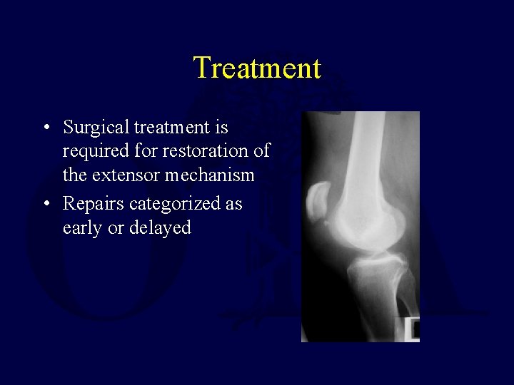 Treatment • Surgical treatment is required for restoration of the extensor mechanism • Repairs