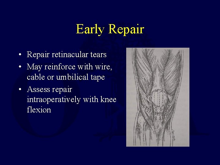 Early Repair • Repair retinacular tears • May reinforce with wire, cable or umbilical