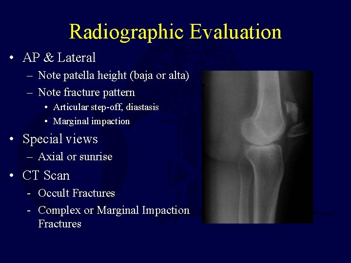 Radiographic Evaluation • AP & Lateral – Note patella height (baja or alta) –