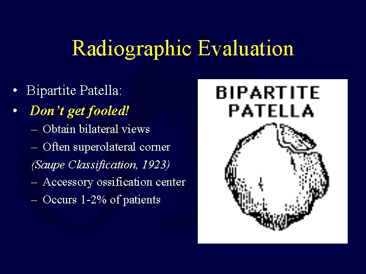 Radiographic Evaluation • Bipartite Patella: • Don’t get fooled! – Obtain bilateral views –