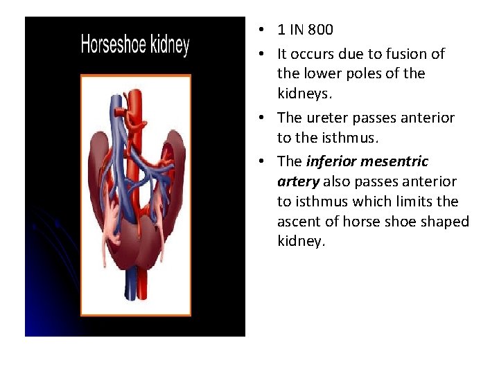  • 1 IN 800 • It occurs due to fusion of the lower