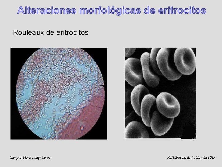 Alteraciones morfológicas de eritrocitos Rouleaux de eritrocitos Campos Electromagnéticos XIII Semana de la Ciencia