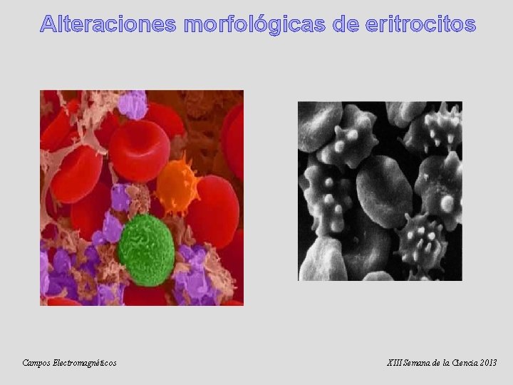 Alteraciones morfológicas de eritrocitos Campos Electromagnéticos XIII Semana de la Ciencia 2013 