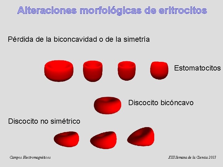 Alteraciones morfológicas de eritrocitos Pérdida de la biconcavidad o de la simetría Estomatocitos Discocito