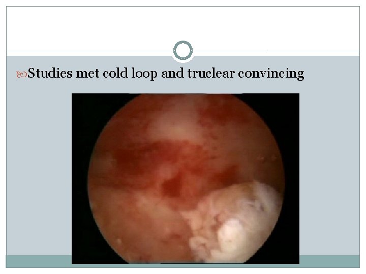  Studies met cold loop and truclear convincing 