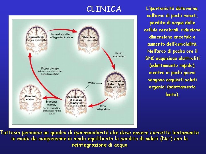 CLINICA L’ipertonicitò determina, nell’arco di pochi minuti, perdita di acqua dalle cellule cerebrali, riduzione
