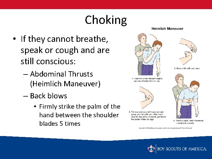 Choking • If they cannot breathe, speak or cough and are still conscious: –