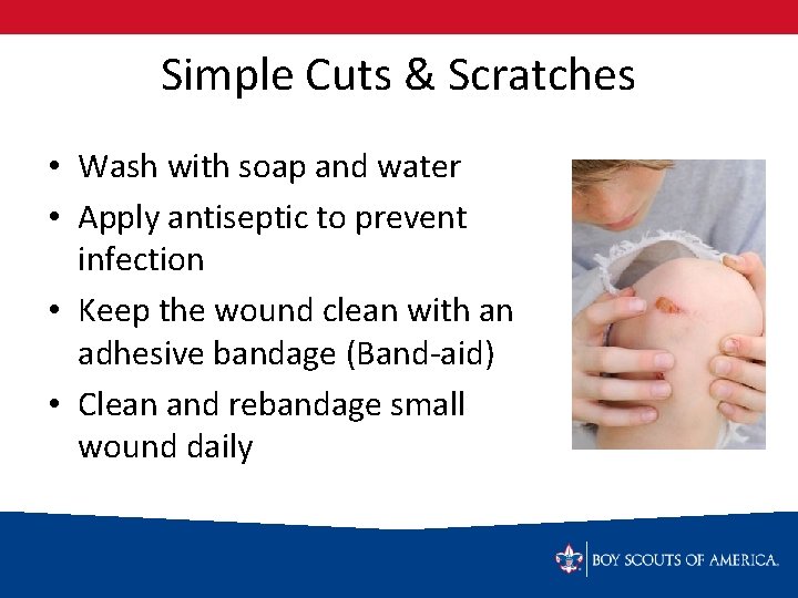 Simple Cuts & Scratches • Wash with soap and water • Apply antiseptic to