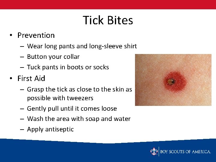Tick Bites • Prevention – Wear long pants and long-sleeve shirt – Button your