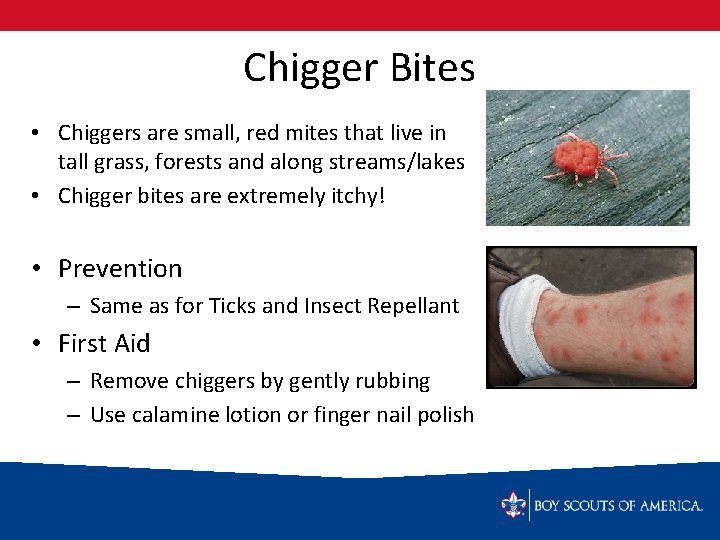 Chigger Bites • Chiggers are small, red mites that live in tall grass, forests