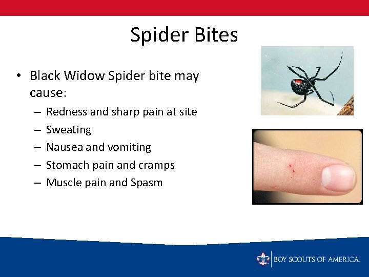 Spider Bites • Black Widow Spider bite may cause: – – – Redness and