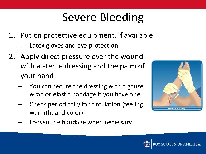 Severe Bleeding 1. Put on protective equipment, if available – Latex gloves and eye