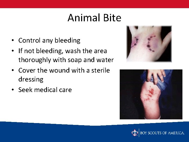 Animal Bite • Control any bleeding • If not bleeding, wash the area thoroughly