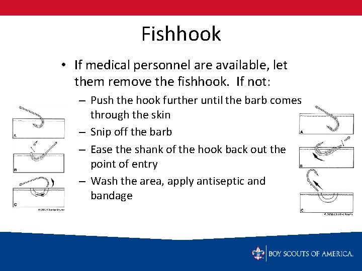 Fishhook • If medical personnel are available, let them remove the fishhook. If not: