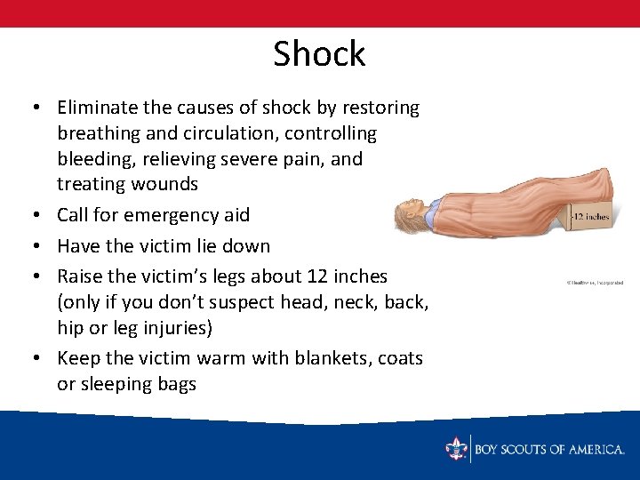 Shock • Eliminate the causes of shock by restoring breathing and circulation, controlling bleeding,