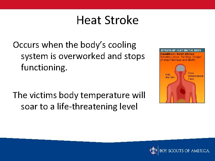 Heat Stroke Occurs when the body’s cooling system is overworked and stops functioning. The