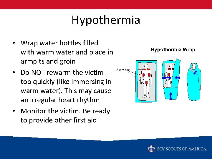 Hypothermia • Wrap water bottles filled with warm water and place in armpits and