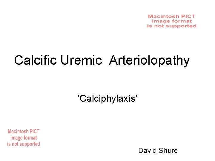 Calcific Uremic Arteriolopathy ‘Calciphylaxis’ David Shure 