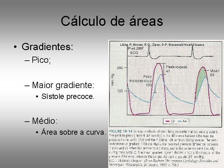 Cálculo de áreas • Gradientes: – Pico; – Maior gradiente: • Sístole precoce. –