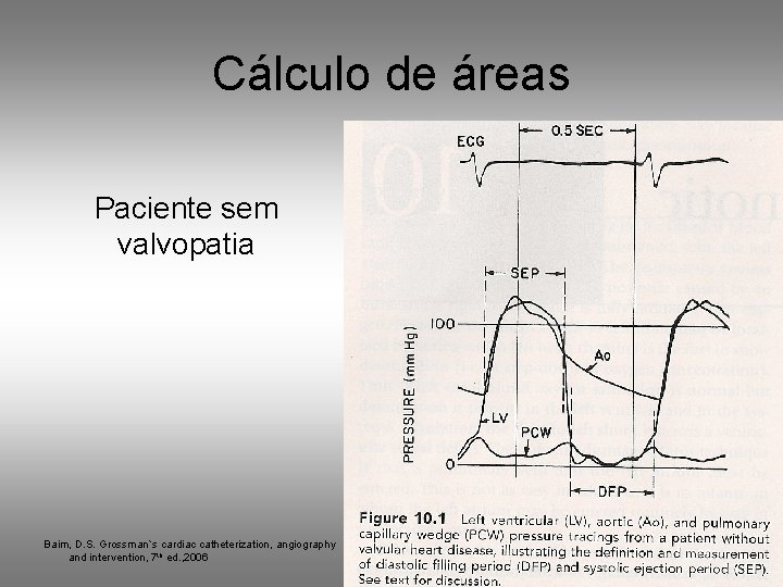 Cálculo de áreas Paciente sem valvopatia Baim, D. S. Grossman`s cardiac catheterization, angiography and