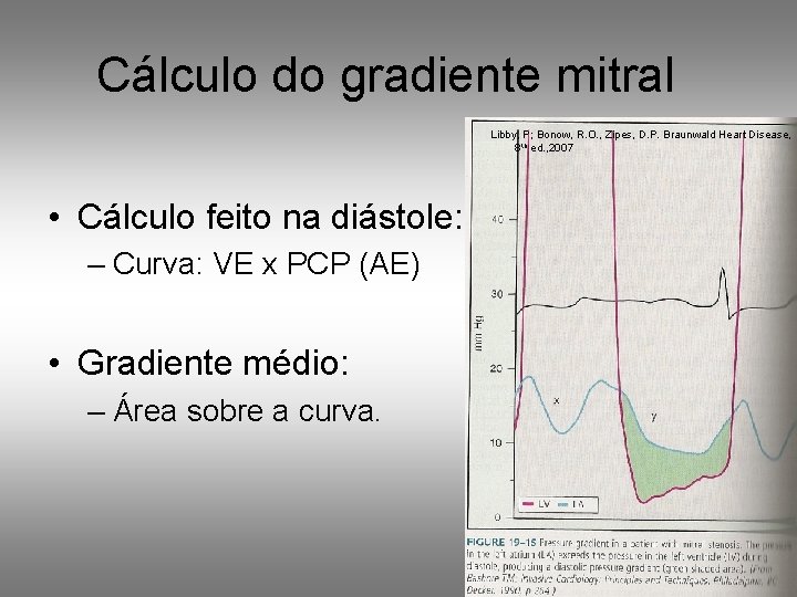 Cálculo do gradiente mitral Libby, P; Bonow, R. O. , Zipes, D. P. Braunwald