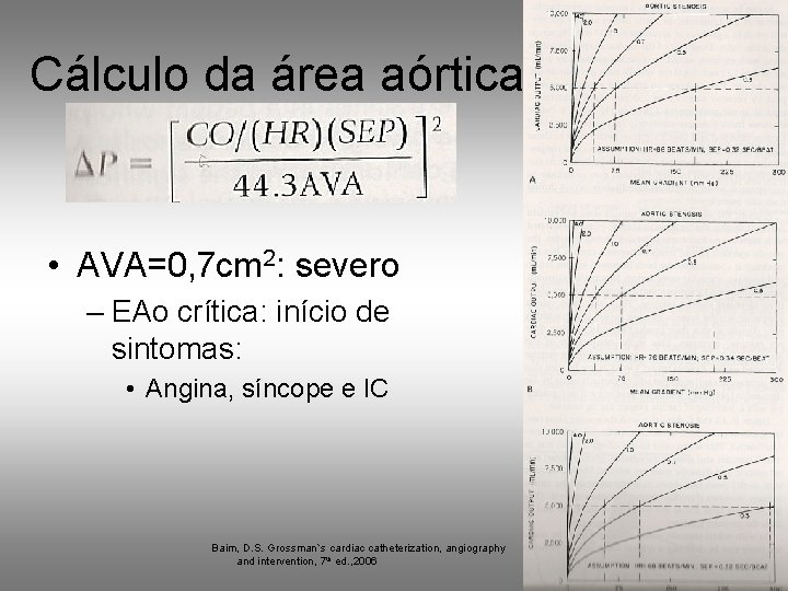 Cálculo da área aórtica • AVA=0, 7 cm 2: severo – EAo crítica: início