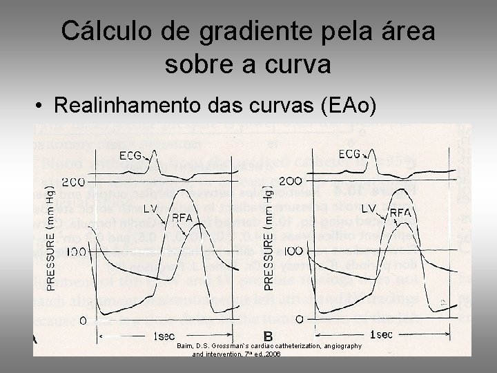 Cálculo de gradiente pela área sobre a curva • Realinhamento das curvas (EAo) Baim,