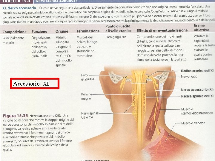 Accessorio XI 