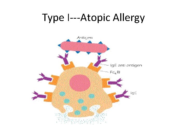 Type I---Atopic Allergy 