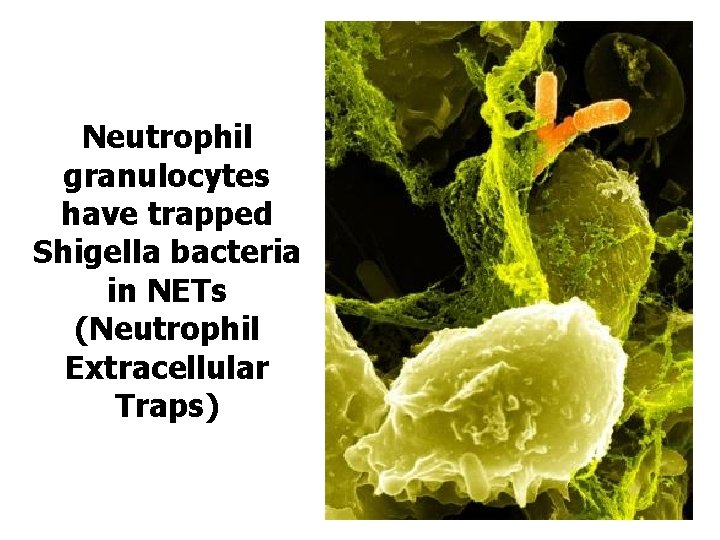 Neutrophil granulocytes have trapped Shigella bacteria in NETs (Neutrophil Extracellular Traps) 