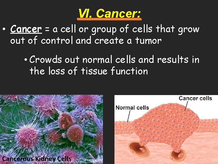 VI. Cancer: • Cancer = a cell or group of cells that grow out