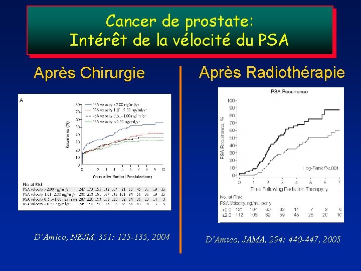 Cancer de prostate: Intérêt de la vélocité du PSA Après Chirurgie D’Amico, NEJM, 351: